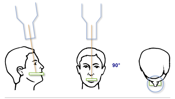 Teeth Radiography