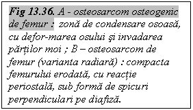 Text Box: Fig 13.36. A - osteosarcom osteogenic de femur :  zona de condensare osoasa, cu defor-marea osului si invadarea partilor moi ; B - osteosarcom de femur (varianta radiara) : compacta femurului erodata, cu reactie periostala, sub forma de spicuri perpendiculari pe diafiza.