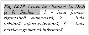 Text Box: Fig 12.18. Liniile lui Ginestet Le Dinh si R. Buchet : 1 - linia fronto-zigomatica superioara, 2 - linia orbitara infero-exterioara, 3 - linia maxilo-zigomatica inferioara.